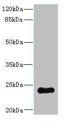 RGS2 Antibody