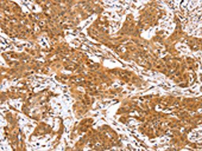 RGS22 Antibody