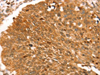 RGS22 Antibody
