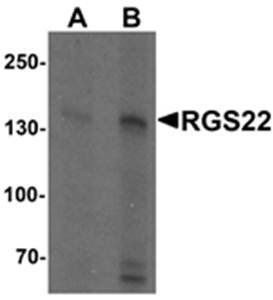 RGS22 Antibody