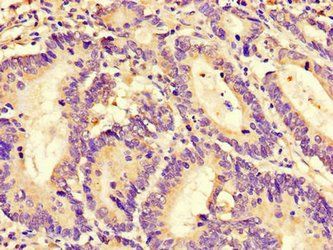 RGS4 Antibody