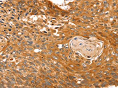 RGS4 Antibody