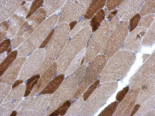 RGS4 antibody