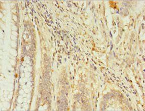 RGS7 Antibody