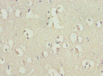 RGS7 Antibody