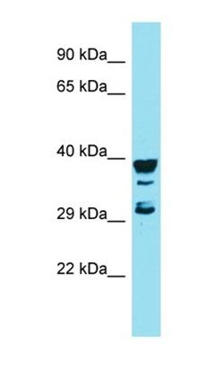 RGS7BP antibody