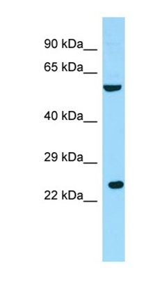 RGS9BP antibody