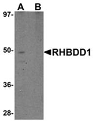 RHBDD1 Antibody