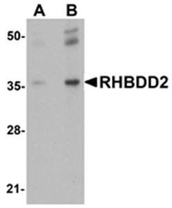 RHBDD2 Antibody