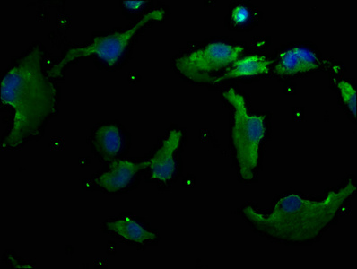 RHBDD3 Antibody