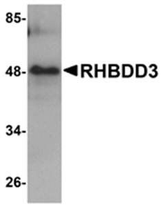 RHBDD3 Antibody