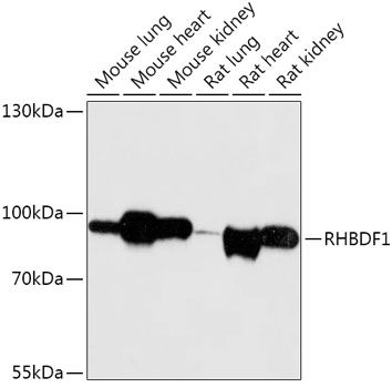RHBDF1 antibody