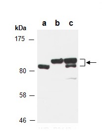 RHBDF2 (N1) Antibody, Rabbit Polyclonal