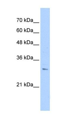 RHBDL2 antibody