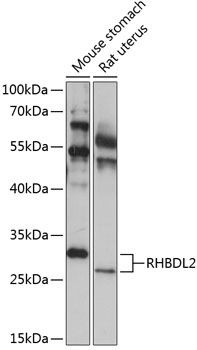 RHBDL2 antibody