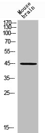 RHD antibody