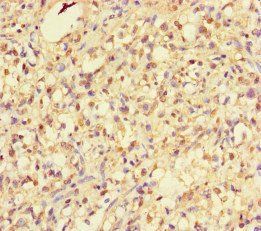 RHEB Antibody