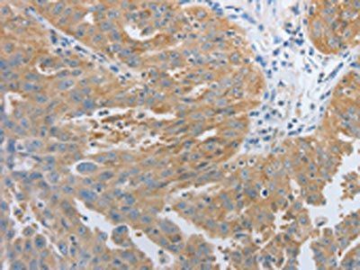 RHEB Antibody