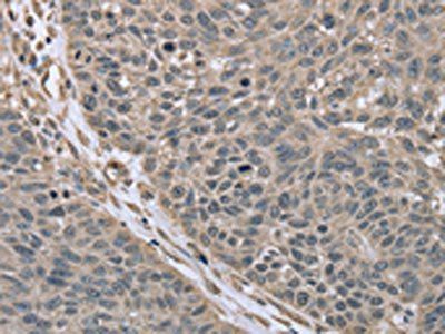 RHEB Antibody