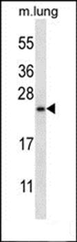 RHEBL1 antibody