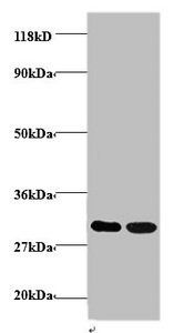 Rho guanine nucleotide exchange factor 18 antibody