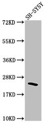 RHOA Recombinant Monoclonal Antibody