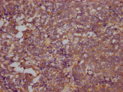 RHOA Recombinant Monoclonal Antibody