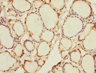 RHOBTB1 Antibody