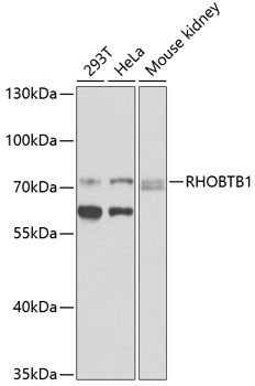 RHOBTB1 antibody