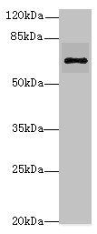 RHOBTB3 Antibody