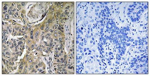 RHOBTB3 Antibody