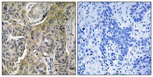 RHOBTB3 antibody