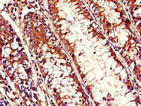 RHOH Antibody