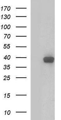 RHOJ Antibody