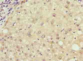 RHOJ Antibody