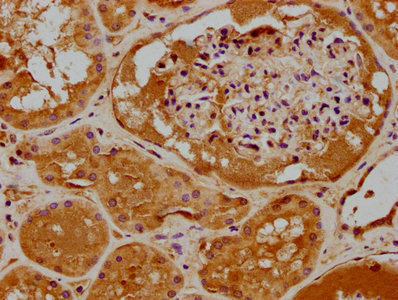 RHOT2 antibody