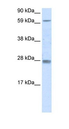RHOX11 antibody