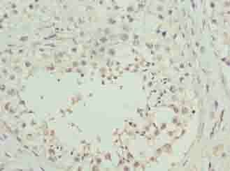 RHPN1-AS1 antibody