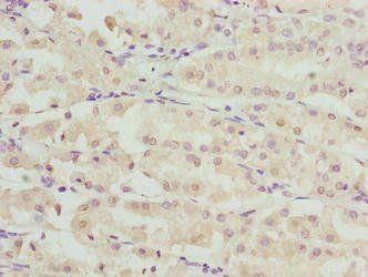 RIBC2 Antibody