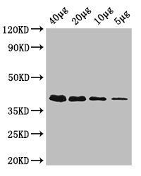 Ribokinase antibody (HRP)