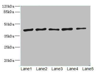 RRM2 Antibody