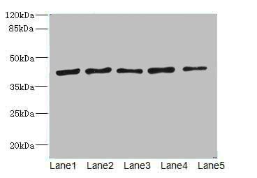 Ribonucleoside-diphosphate reductase subunit M2 antibody