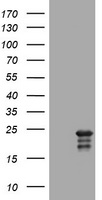 Ribophorin II (RPN2) antibody