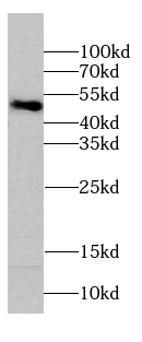ribosomal protein L4 antibody