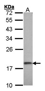 ribosomal protein S10 antibody