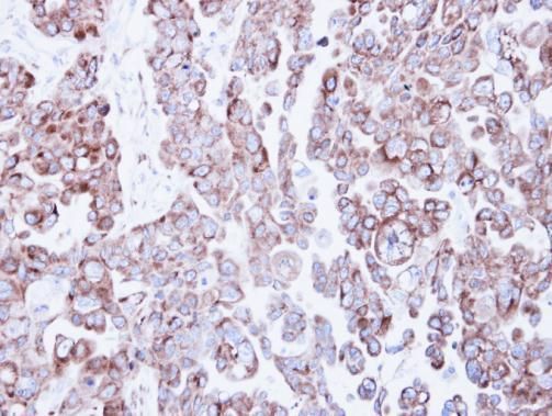Ribosome binding protein 1 Rabbit Polyclonal Antibody