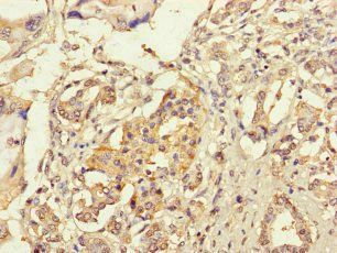 RIC1 Antibody