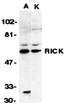 RICK Antibody