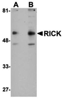 RICK Antibody