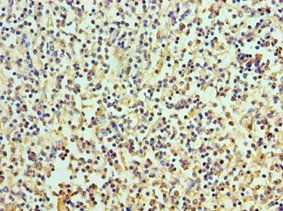 RICTOR Antibody